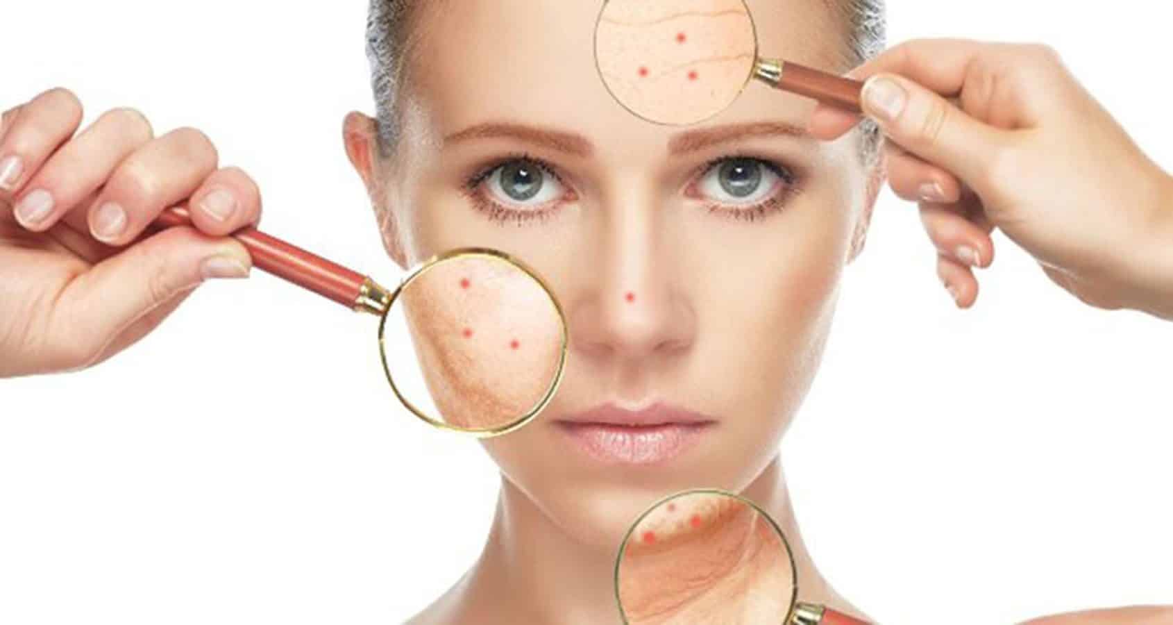web-acne-mulher-com-lente-de-aumento