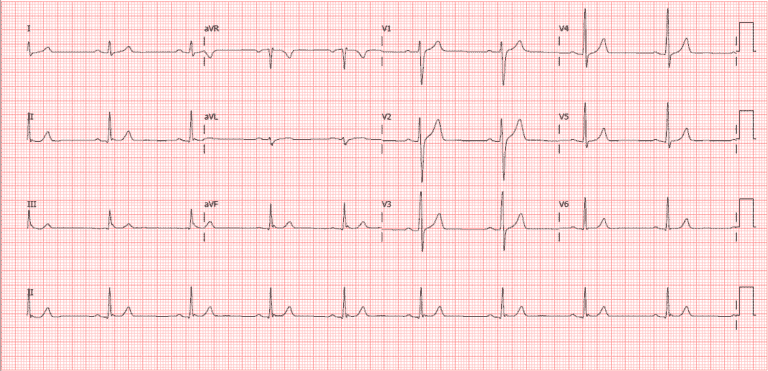 Imagens Autênticas de Eletrocardiogramas