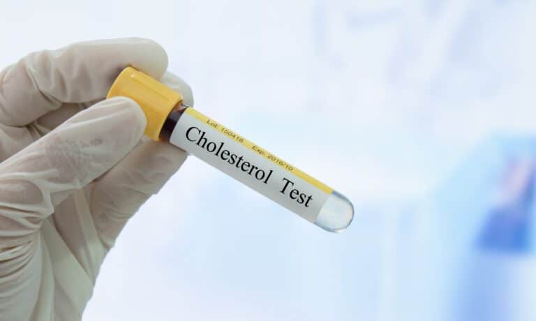 Como melhorar o LDL-colesterol e o colesterol total? 4 Como melhorar o LDL-colesterol e o colesterol total?