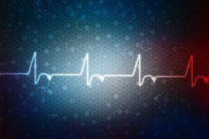 eletrocardiograma - ECG