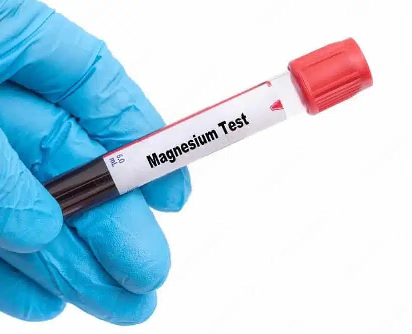Imagem mostrando um tubo de coleta de exame de sangue de magnésio
