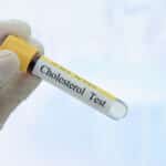 Colesterol Teste