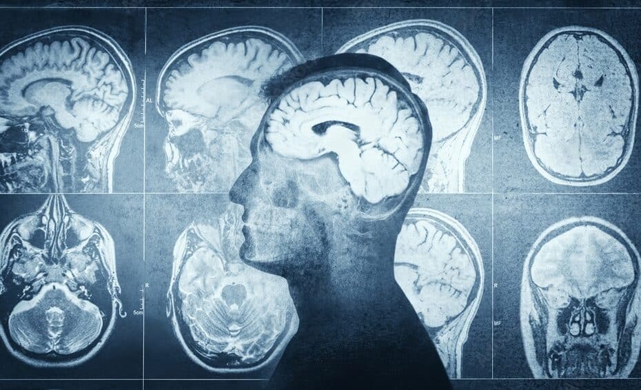 Imagem tomográfica de um cérebro gerada por IA