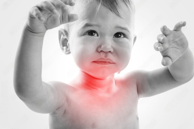 Entendendo o Refluxo Gastroesofágico em Bebês 11 bebe com a garganta inflamada devido ao Refluxo Gastroesofágico