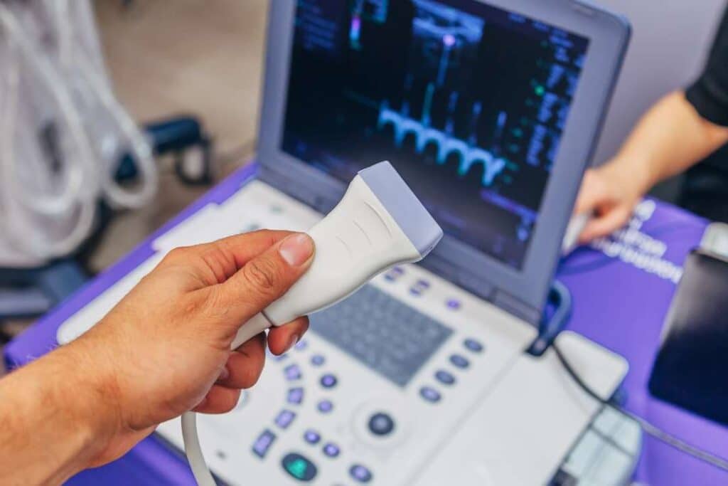 médico segurando o equipamento que realiza a ultrassonografia