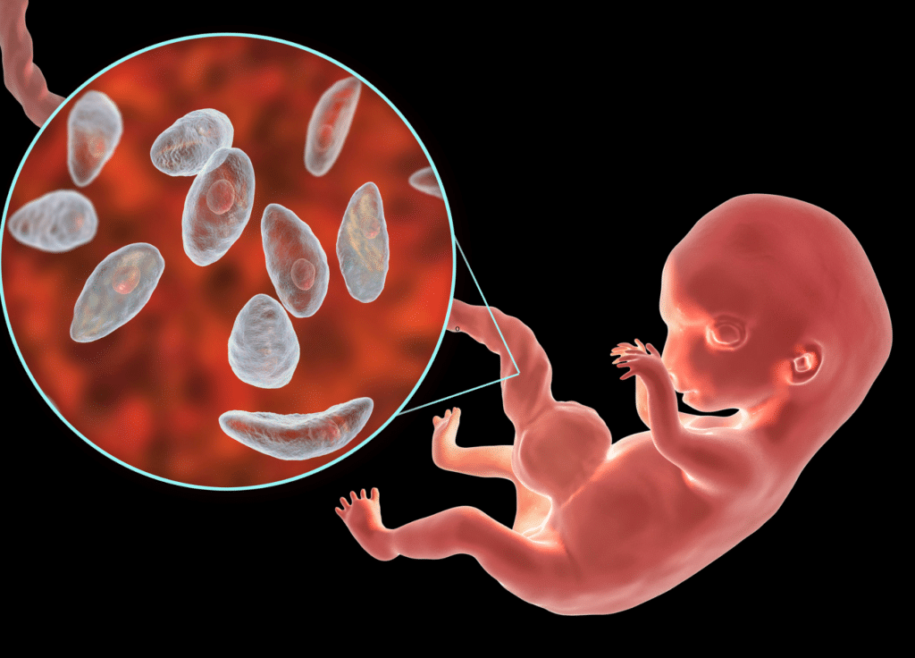 toxoplasmose no feto